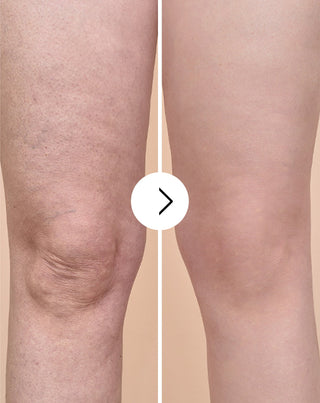 Cellulite- og hudforbedringstabletter med naturlige ekstrakter Cellinea 60 kapsler - 5