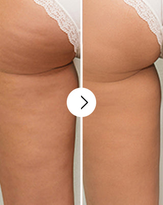 Cellulite- og hudforbedringstabletter med naturlige ekstrakter Cellinea 60 kapsler_2 - 2