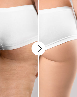 Cellulite- og hudforbedringstabletter med naturlige ekstrakter Cellinea 60 kapsler_3 - 3