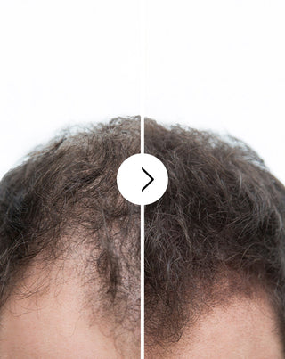 Kapsler mod hårtab med fortykkende og styrkende effekt Follixin 60 kapsler_2 - 2