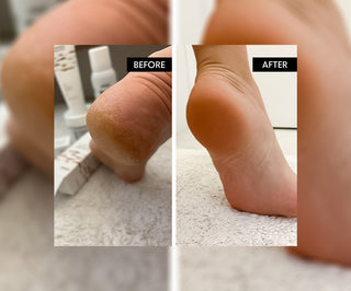 Fodbadesalt med urea 45% Refeet