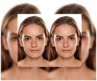 Akne, bumser og ujævnheder - tabletter med zink, C-, E- og B2-vitamin Derminax - 6