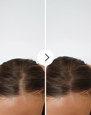 Kapsler mod hårtab med fortykkende og styrkende effekt Follixin 60 kapsler