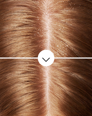 Anti-skælshampoo med olaminpyrocton med fugtgivende virkning Nutridome - 5