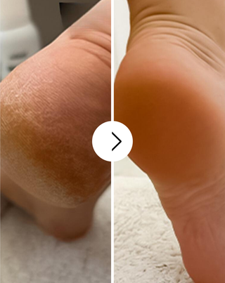 Nutridome blødgørende fodcreme med urea og sheasmør - 4