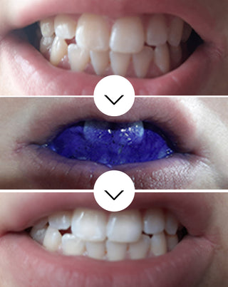 White Bite Smilebite tandfarvekorrigerende serum 30 ml