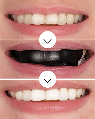 The White(ning) Stripes Smilebite tandblegningsstrips sæt med 28 stk. - 3